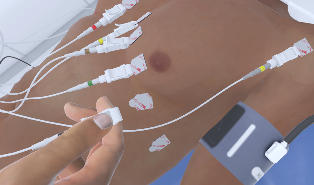 beeld uit de ecg-module
