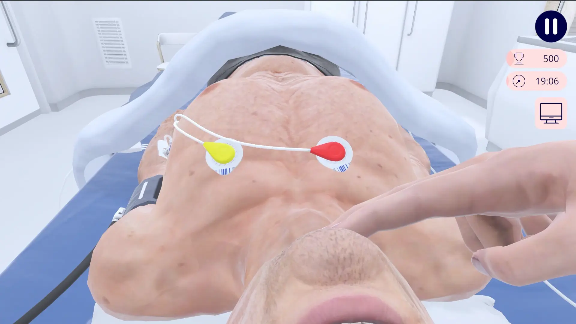 defibrillatie, plaatsing van de pads