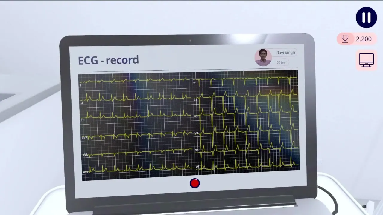 beeld uit de ECG-module: systematisch analyseren